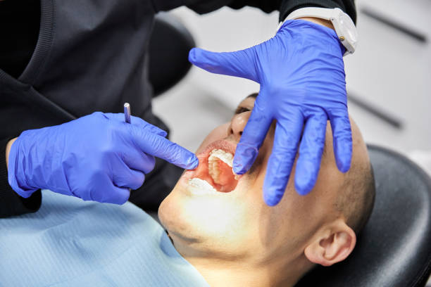 Best Emergency Dental Care for Sports Injuries in Hide A Way Lake, MS
